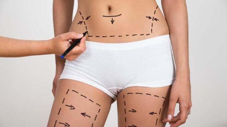 Ünlü estetikçiden ‘annelik estetiği’ uyarısı: Bunu kesinlikle önermiyoruz