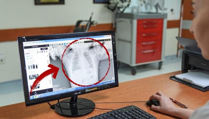 Ankara’da şoke eden olay! 10 aylık bebek aniden kusmaya başladı, ortaya çıkan gerçek yürekleri ağza getirdi