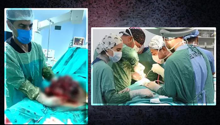 Yıllarca karnında taşımış! Tam 10 kilo… Karın ağrısı şikayetiyle hastaneye gitmese fark etmeyecekti