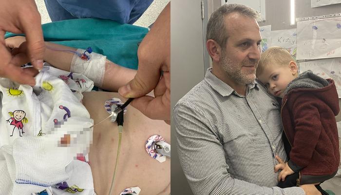 2 yaşındaki çocuk 1,5 aydır öksürük nöbeti geçiriyordu! Sebebi akciğerindeki fındık çıktı