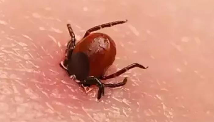 Kene; elle tutup çekilmez, tırnakla ezilmez! Yüzde 100 bulaşma riski var! 4 kişi hayatını kaybetti: Özelliklere vücutta bu bölgelere yapışıyor