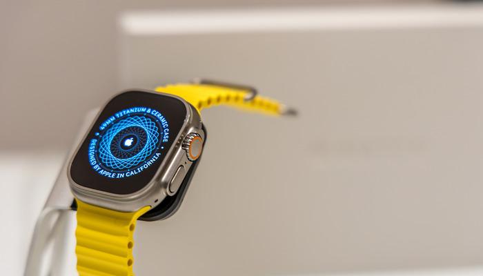 2026 Apple Watch serisi için dikkat çeken iddialar: Son yılların en büyük yükseltmesi olabilir