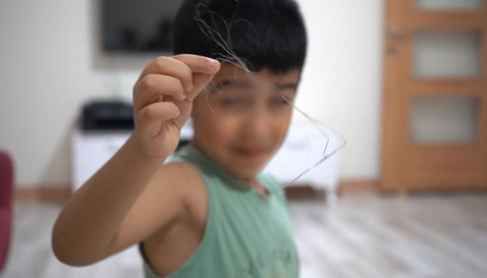 3 yıl sonra ortaya çıktı: 18 santimlik katerer unutmuşlar! Salatalık yutunca ortaya çıktı