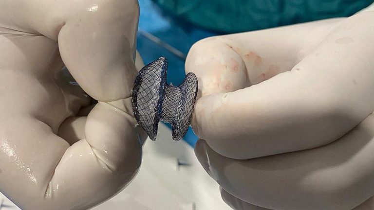 Çarpıntı, nefes darlığı ve yorgunluk varsa dikkat! Kalp deliği artık kapalı yöntemle tedavi edilebiliyor